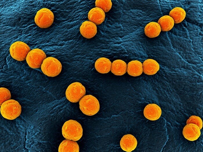 Enterococcus fetium