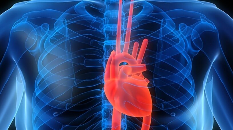 โรคหัวใจและการผ่าตัดหัวใจ