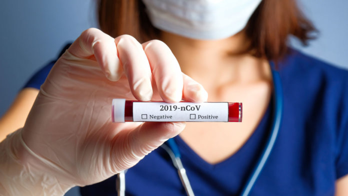 Koronavirus 2019-nCoV