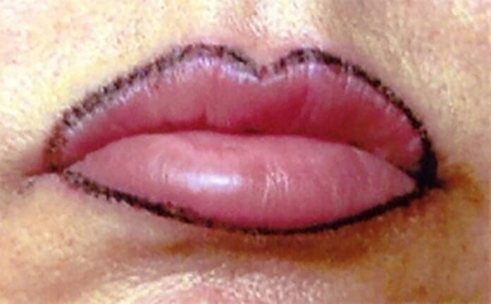 Lip contour